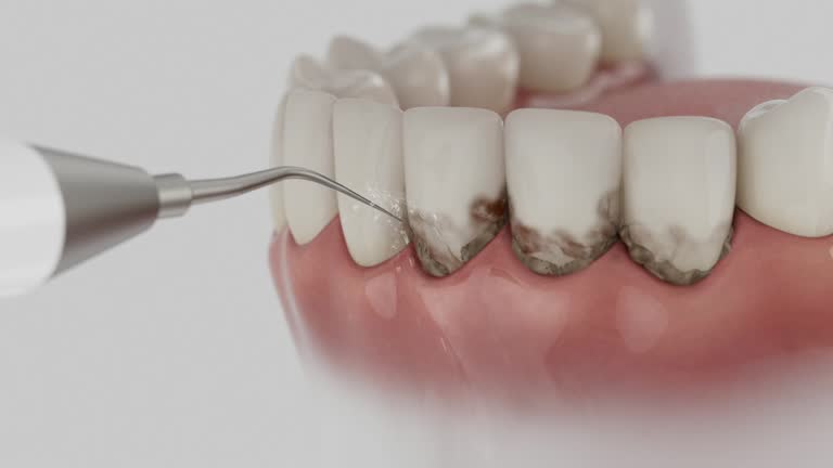 Reliable Dental Implants contractor in Frazer, PA by Smile Center Dentistry